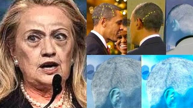 Obama's 3 Head Scars and Hillary's 9/11 Seizure Explained: The Beast Has its Head Wounded