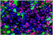 Insulin-producing cells in alginate capsule.