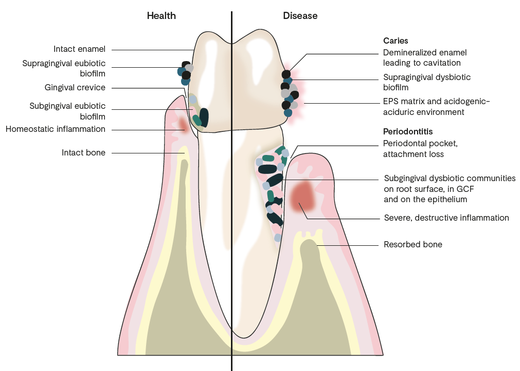 Tooth Health and Disease