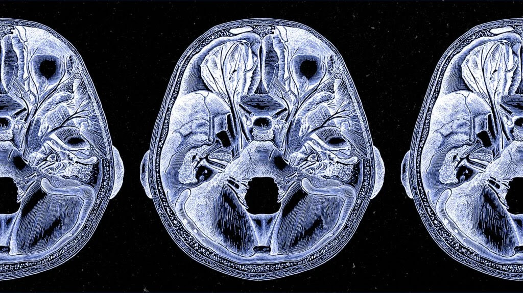 A detailed MRI of the human brain