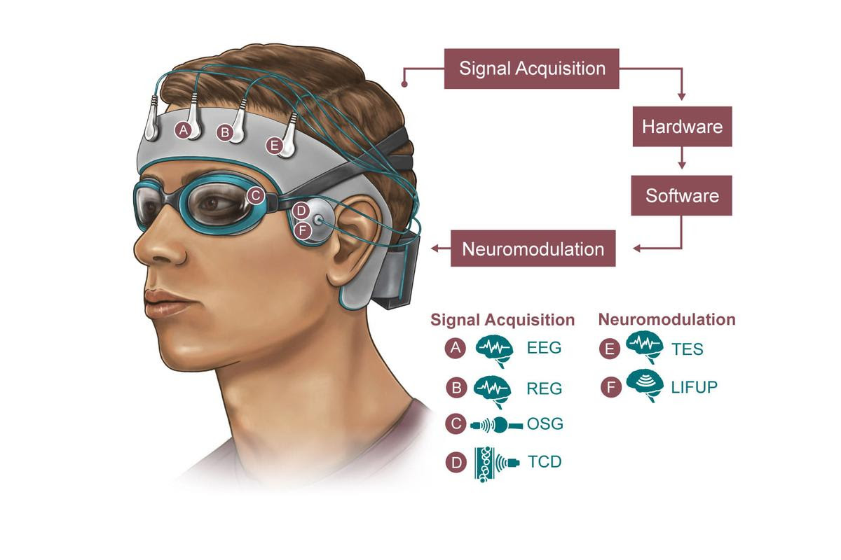 A diagram illustrating what the new sleep-tracking skullcap could look like and how it would work