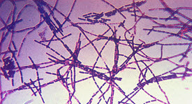 photo anthrax spores