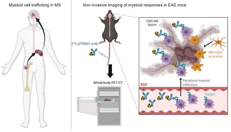 Researchers find molecular signal that could help confirm early diagnosis of multiple sclerosis