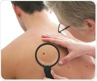 Study reveals link between circulating tumor cells and relapse in late-stage melanoma patients