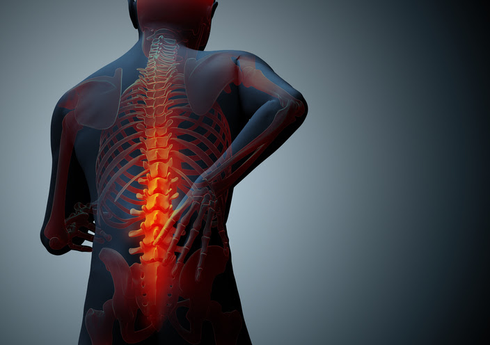 ilustracion de una persona con dolor de espalda