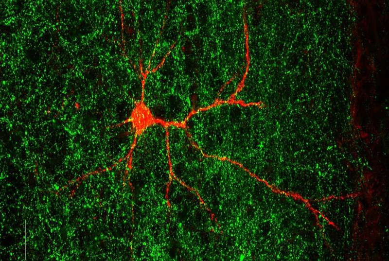 Autism-linked gene shapes nerve connections