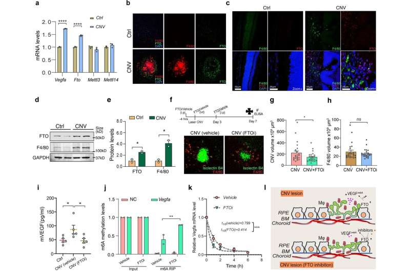 Discovery suggests new way to prevent common causes of vision loss