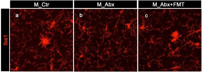 Immune cells in the brain play key role in relationship between gut microbes and -amyloid