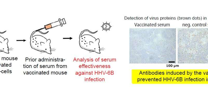 Vaccine developed for human herpesvirus 6B (HHV-6B)