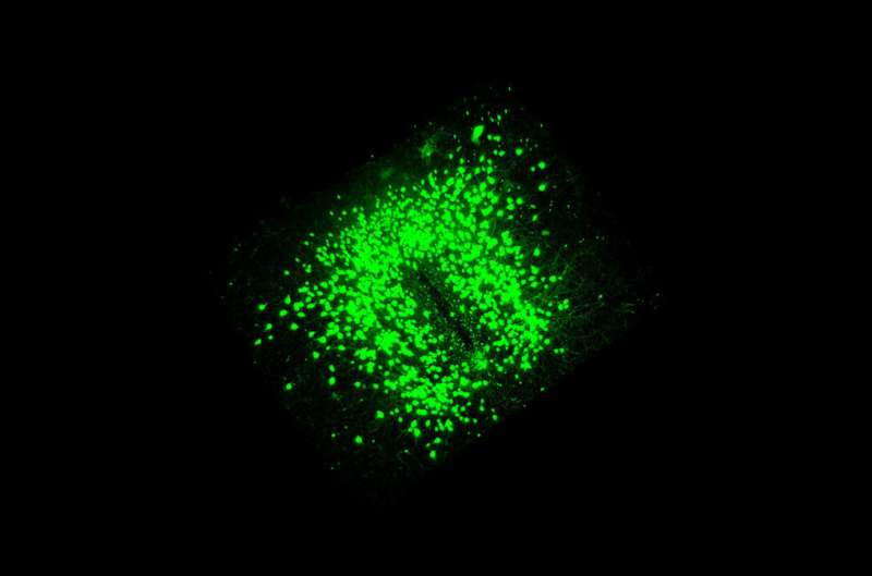 Same nerve cell, different influence on food intake