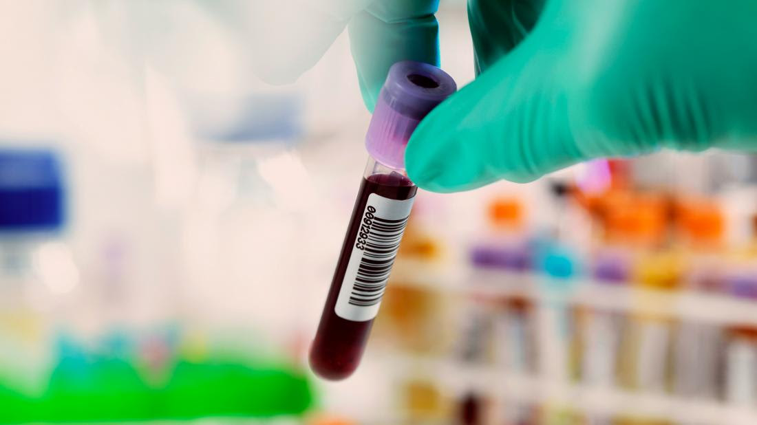 a blood vial that could be used to test for Hepatitis c false positive