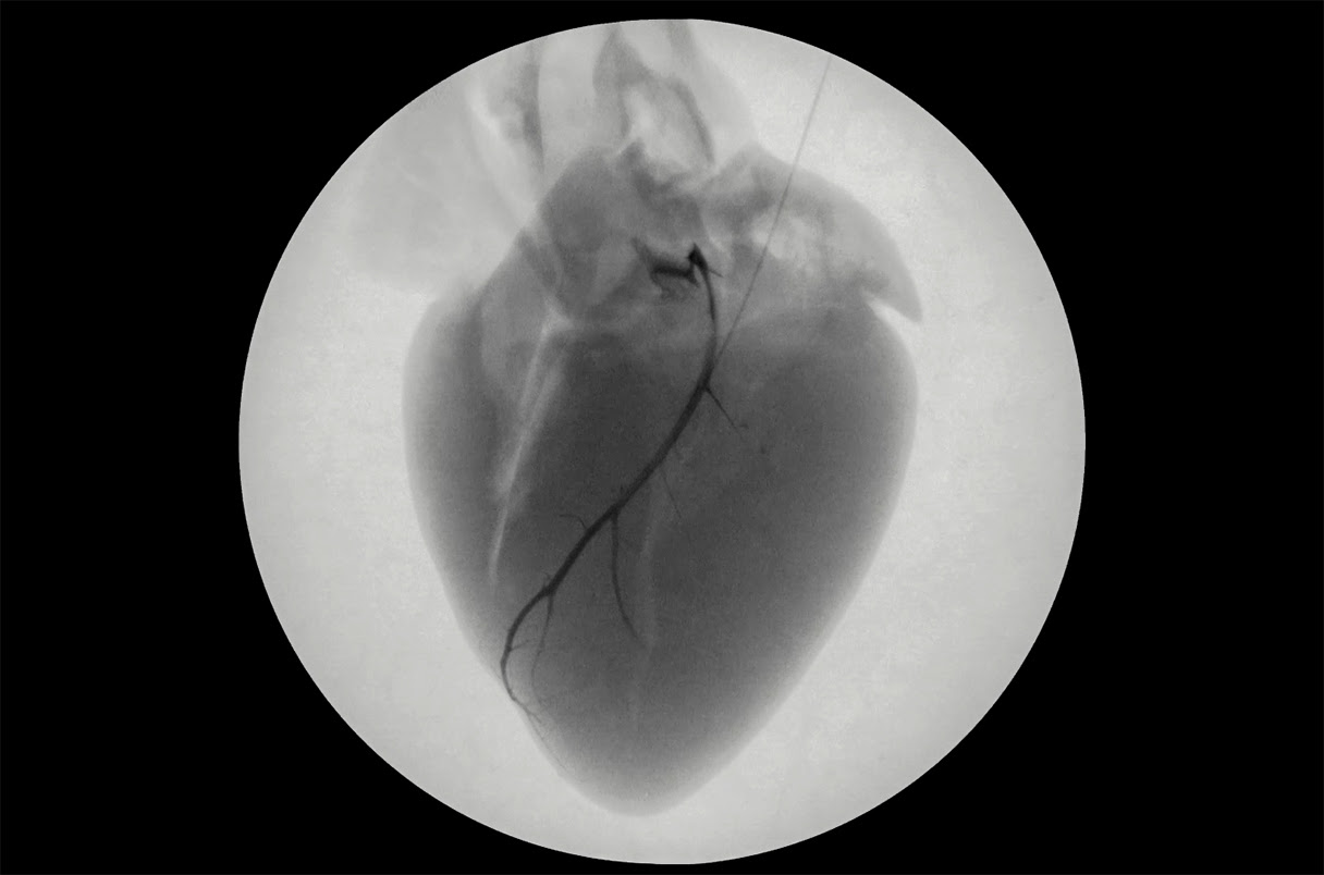 black and white image of a heart with a wire in it