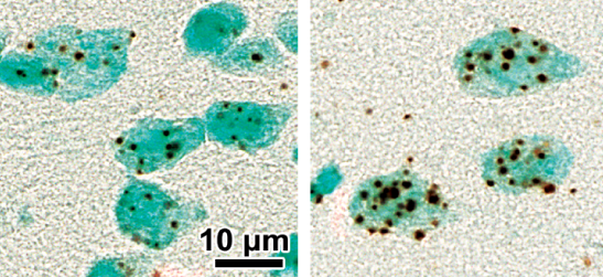 Transporter Imbalance Implicated in Schizophrenia