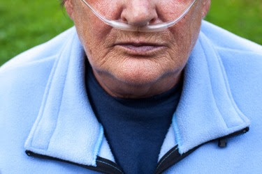 The figure is a photo of an older person with supplemental oxygen.