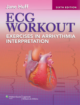 ECG Workout: Exercises in Arrhythmia Interpretation EPUB