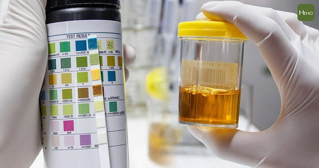 Thận là nhà máy lọc và xử lý chất độc của cơ thể, muốn giữ thận khỏe mạnh thì đừng bao giờ làm 4 việc này - Ảnh 1. Thận là nhà máy lọc và xử lý chất độc của cơ thể, muốn giữ thận khỏe mạnh thì đừng bao giờ làm 4 việc này - Ảnh 1.