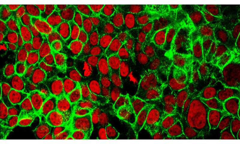 Mathematical model maps out 'arms race' between cancer and immune system, predicts effectiveness of immunotherapy