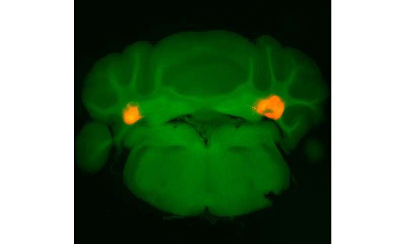 In the brain's cerebellum, a new target for suppressing hunger