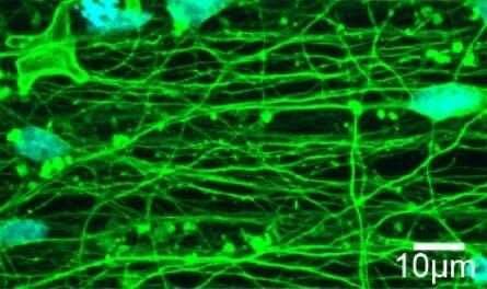 Engineering nerve cells to study the relationship between their shape and function in health and disease