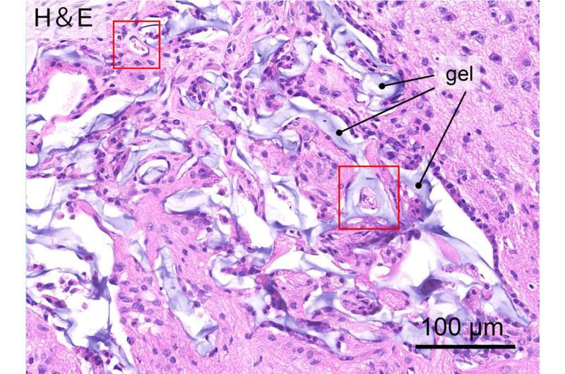 Healing the brain: Hydrogels enable neuronal tissue growth