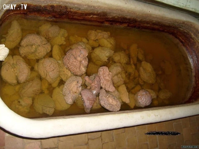 Bồn tắm chứa đầy não người được bảo quản và tìm thấy trong một trại tị nạn Texas bị bỏ hoang,cơ thể con người