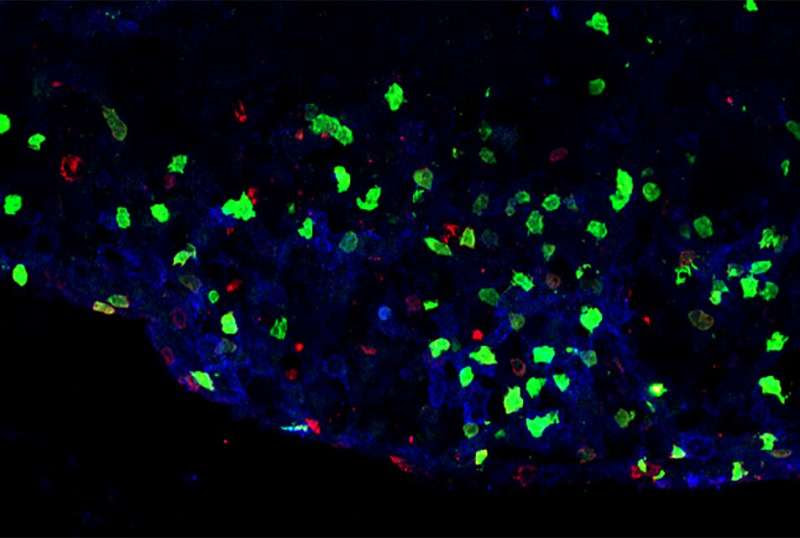 Novel immune cell population may trigger inflammation in multiple sclerosis and other brain disorders