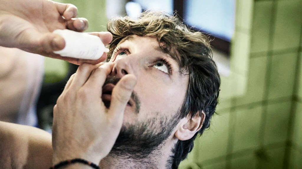 A person applying eye drops to treat dry eye after LASIK surgery.