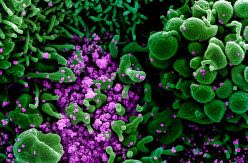 Los misterios que rodean a los anticuerpos contra el coronavirus