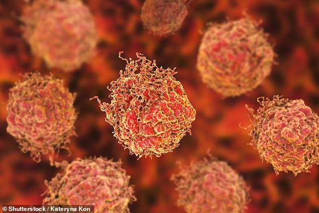 Clinical trials have now begun ¿ with the goal of unleashing cancer-killing white blood cells to attack the tumour. Prostate cancer cells are seen above