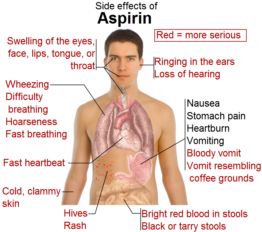 More Harm Than Good: Widespread Aspirin Use Despite Few Benefits, High Risks