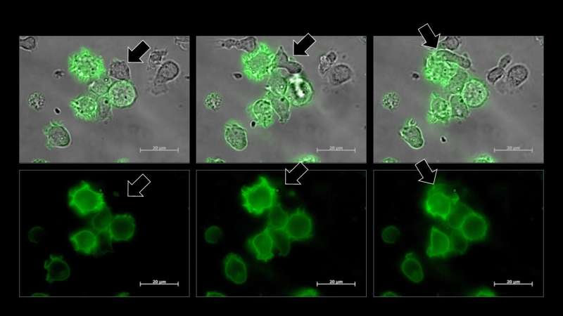 Kiss of sleep: How blood cancer cells put the immune system's Natural Killer cells to sleep