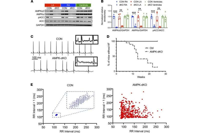 The role of metabolic signaling in preventing atrial fibrillation