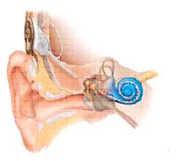 cochlear implant surgery
