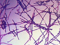 Anthrax.  Image courtesy of the CDC Public Health Image Library