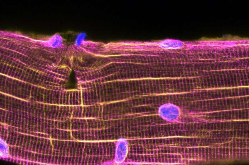 Nuclei on the move for muscle self-repair