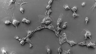 Cancer Cells Killed by Programmed Photorhabdus Virulence Cassettes
