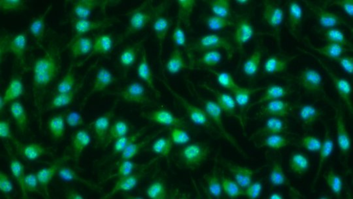 Macrophages in inflammatory phase