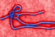 The Ebola Virus virus.