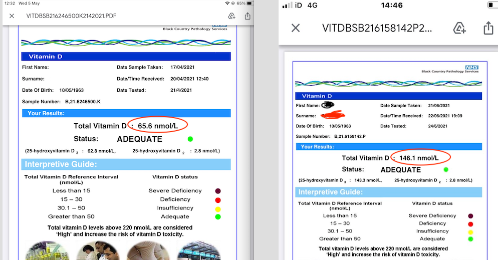 26037926_1644570515hRtKC_before_and_after_vit_d_.png