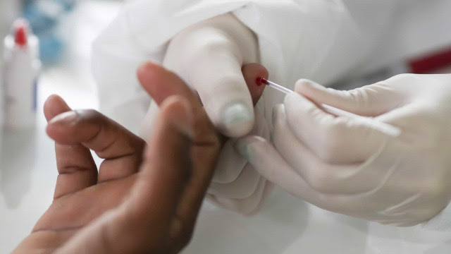 Teste para detectar gripe pode ser feito em farmácias e laboratórios