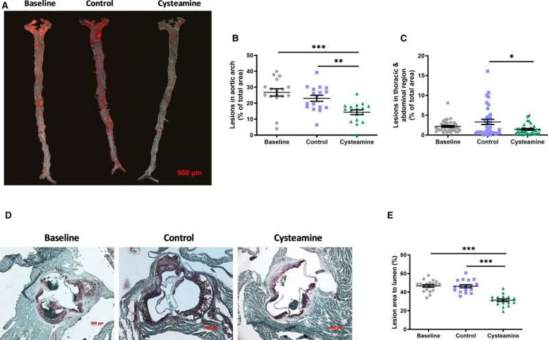 Antioxidant drug reverses process responsible for heart attacks and strokes