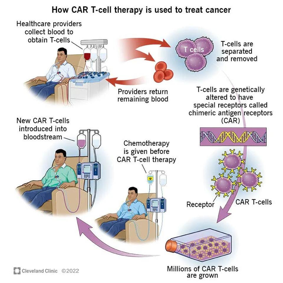 CAR T cell process