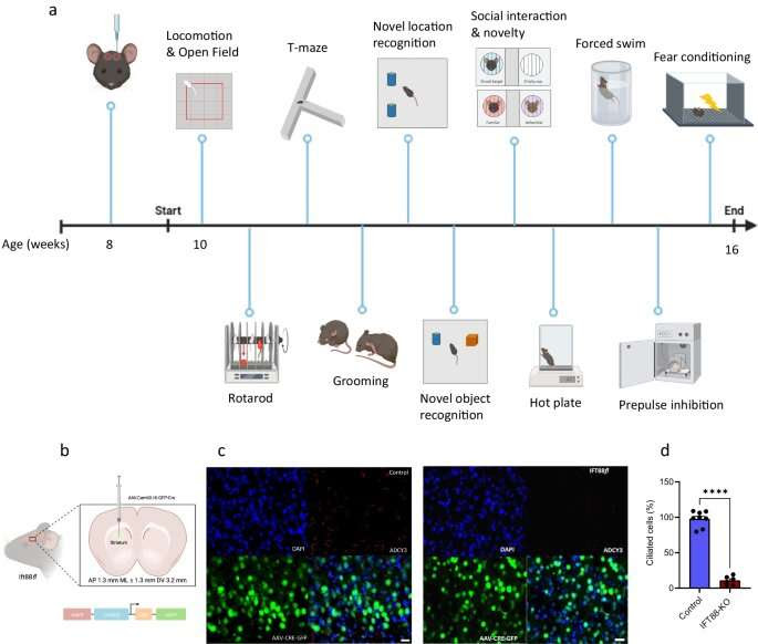 Researchers discover crucial role of brain's striatum cilia in time perception