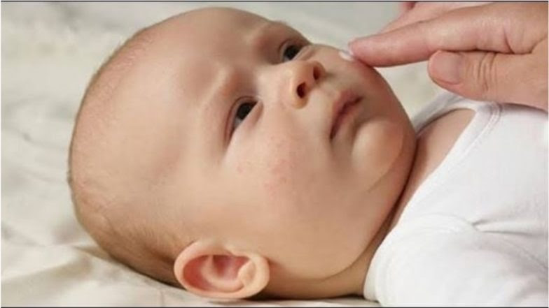 Image result for 6 ways to manage dry and itchy skin in babies