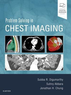 Problem Solving in Chest Imaging PDF