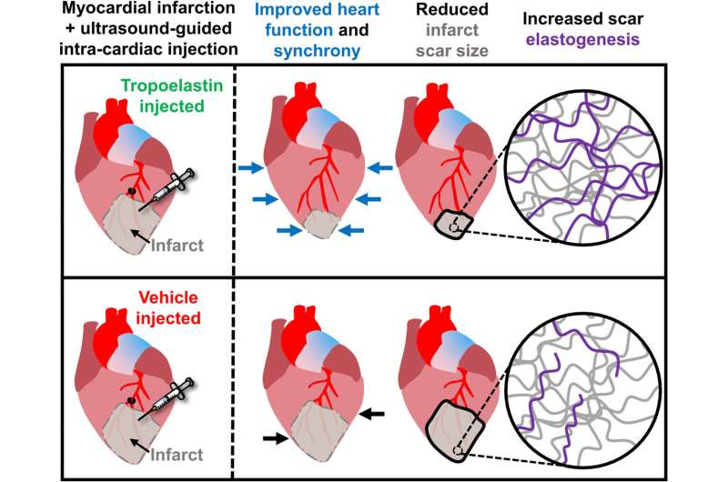 Scientists find way to heal scars left behind by heart attacks