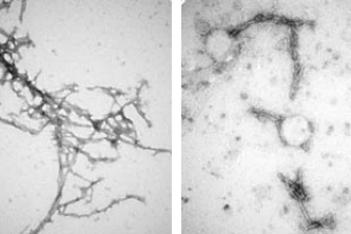 Left: alpha-synuclein clumps, which can accumulate in the brain and are associated with Parkinson's disease. Right: these clumps after being treated with a new nanobody treatment.