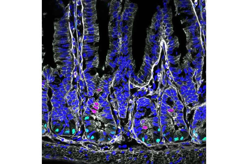 New link between diet, intestinal stem cells and disease discovered