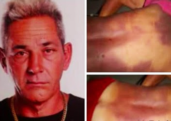 Persisten los asesinatos extrajudiciales de presos en Cuba