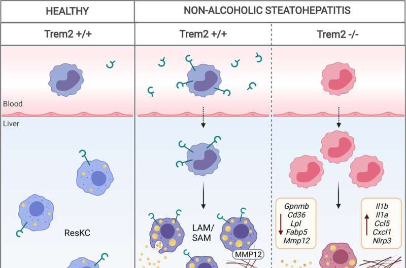 New blood biomarker identified for status of fatty liver disease